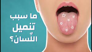 صورة المقال